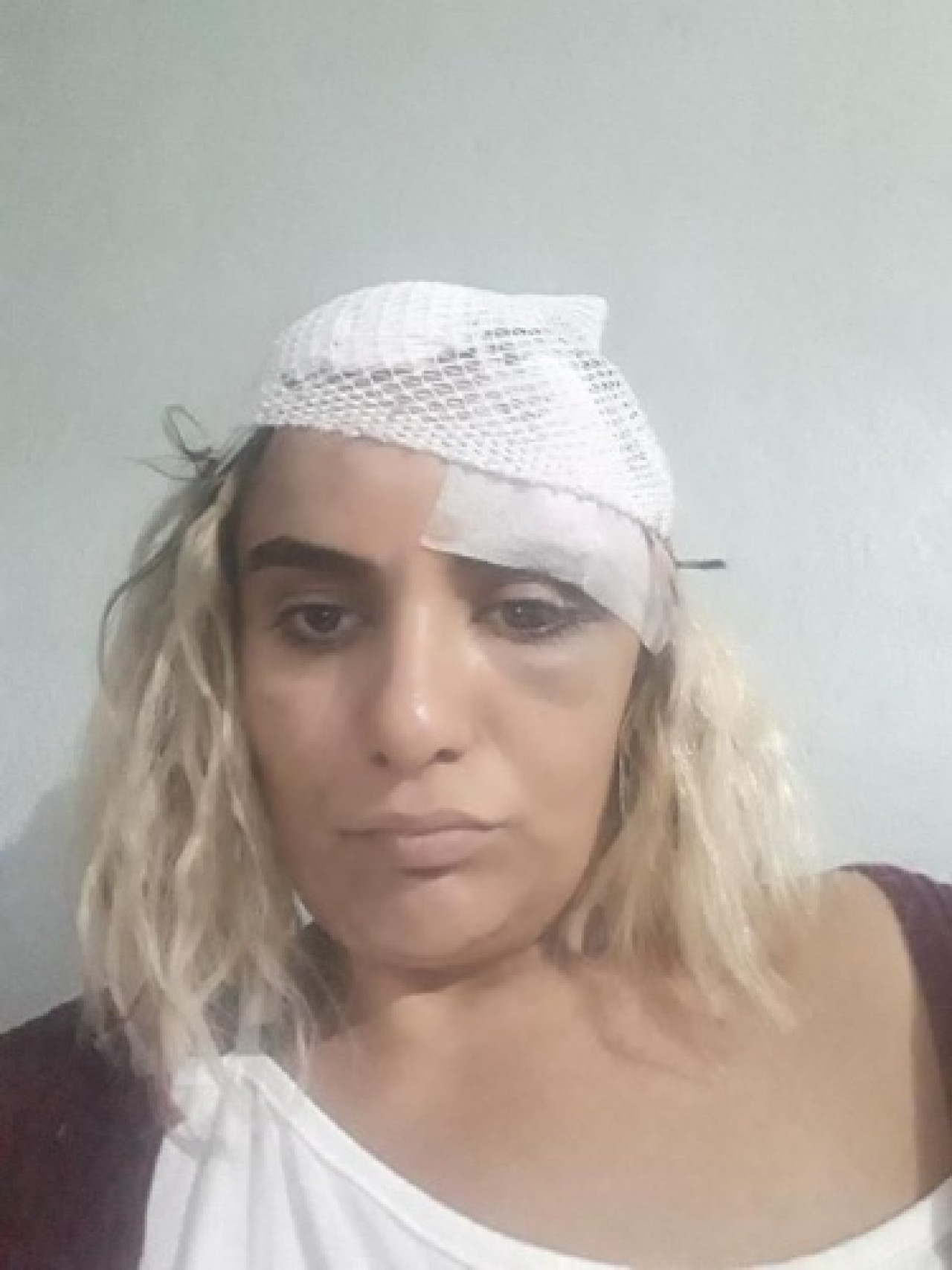 Kısmet Ağar dini nikahlı eşi tarafından öldürülme korkusuyla yaşıyor 3