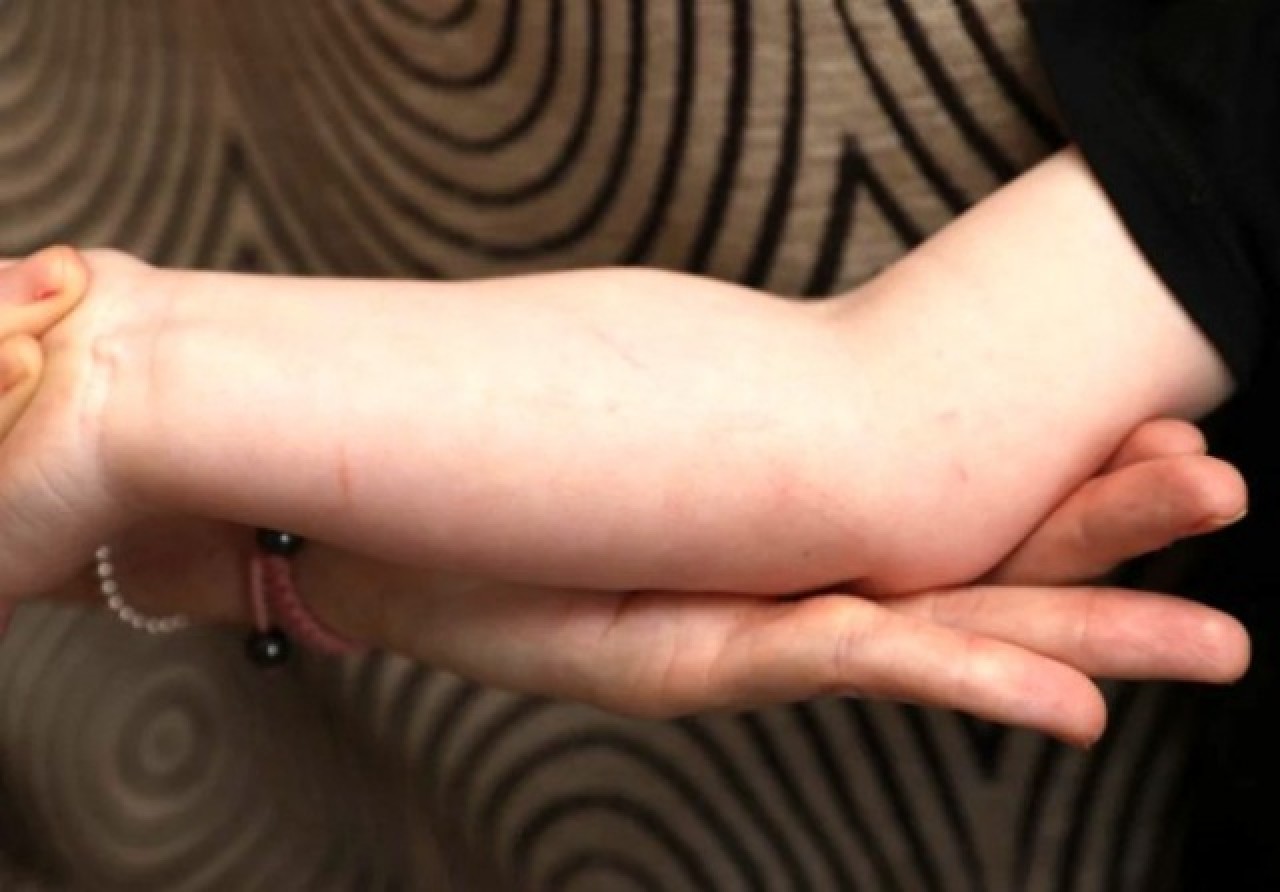 Yavru yarasa 2 yaşındaki çocuğun karyolasına girip,  kabusu yaşattı! 3