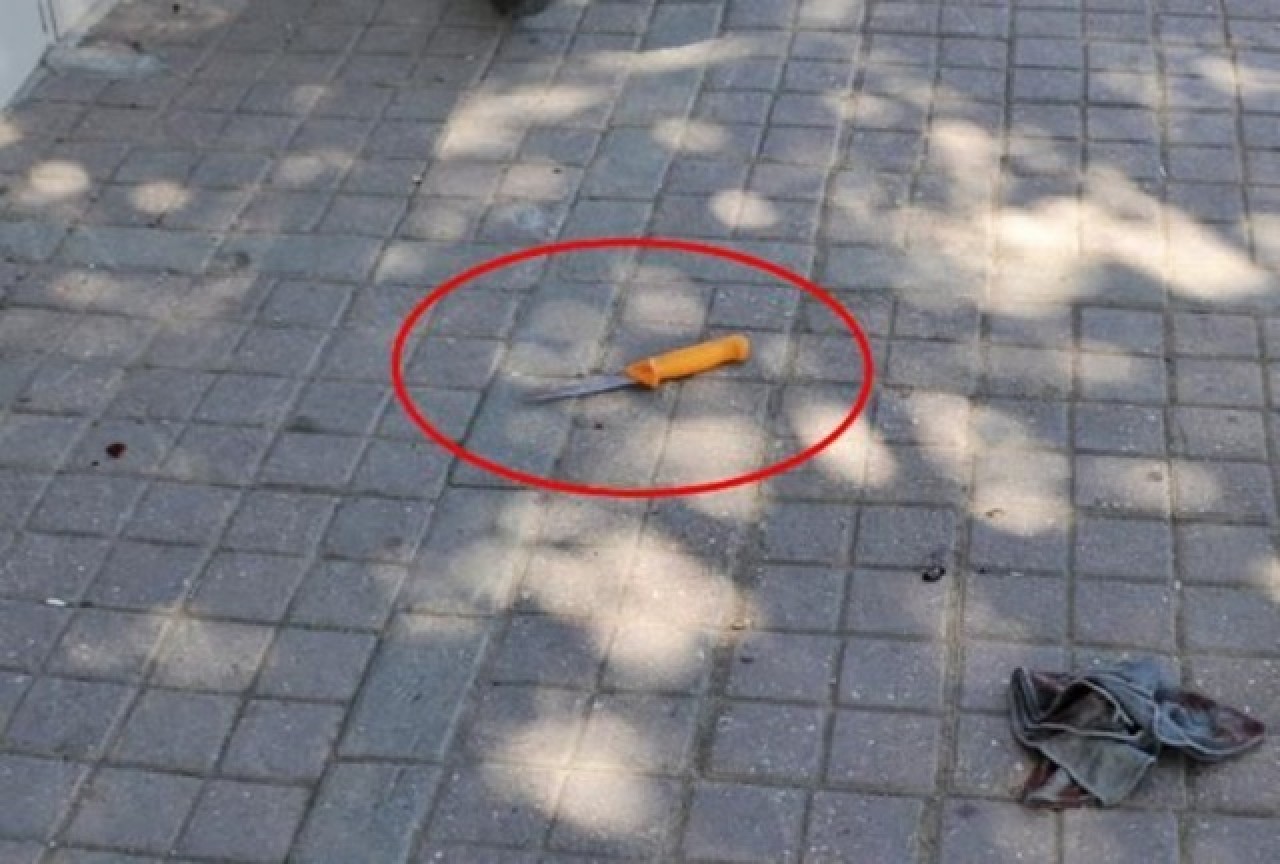 Sırtındaki bıçakla,  Almanya’daki ablasıyla görüntülü görüştü 5