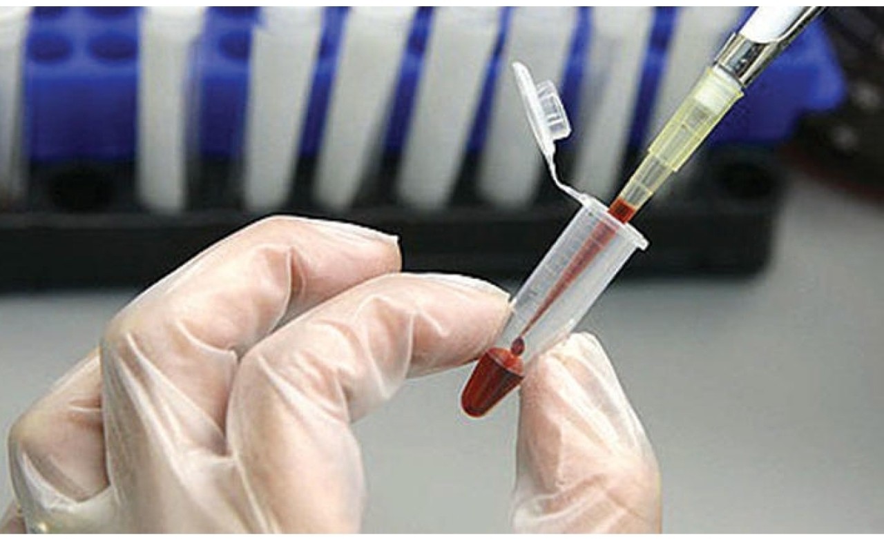 30 dakika içinde bakteri ölçen cihaz geliştirildi