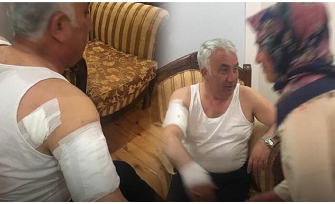 Belediye Başkanına köpek saldırdı: 'Adeta beni parçalamaya çalıştı'