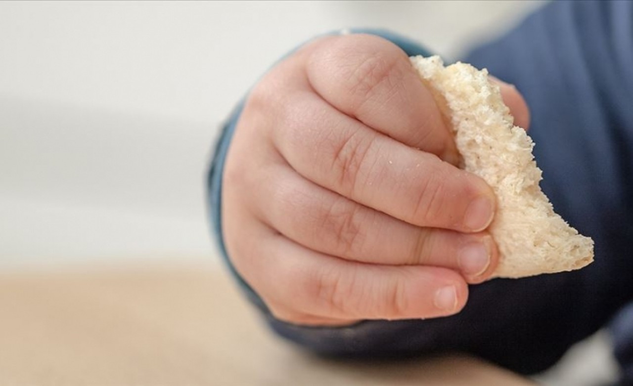 Çocukluk çağı besin alerjilerinin görülme oranı arttı