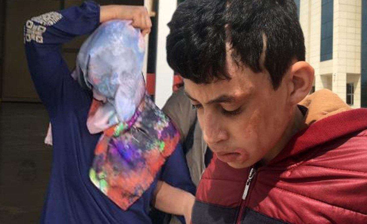 Komşusu ve çocuklarına kezzapla saldırdı,  savunması 'pes' dedirtti!