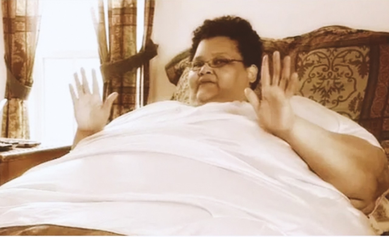 340 kiloya kadar çıkmıştı! Son halini görenler 'Bu mucize' diyor!