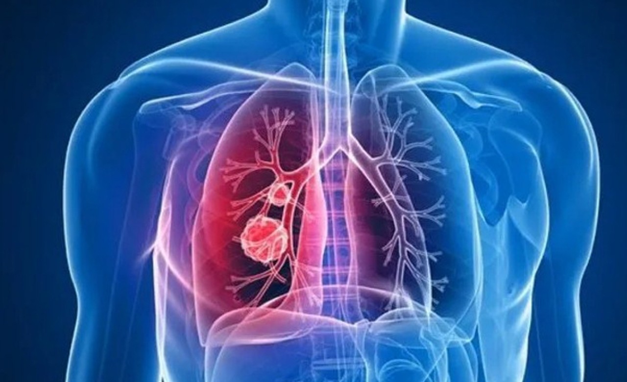 40 yaş üstü her 5 kişiden birinde KOAH tehlikesi