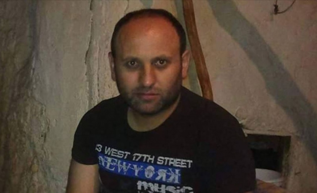 Sivas'ta KKKA şüphesiyle ölüm