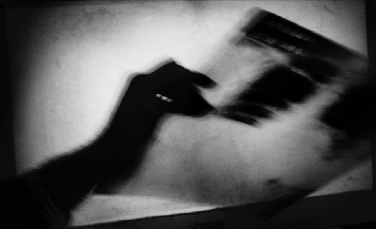 Tüberküloz tanı ve tedavi rehberi güncellendi