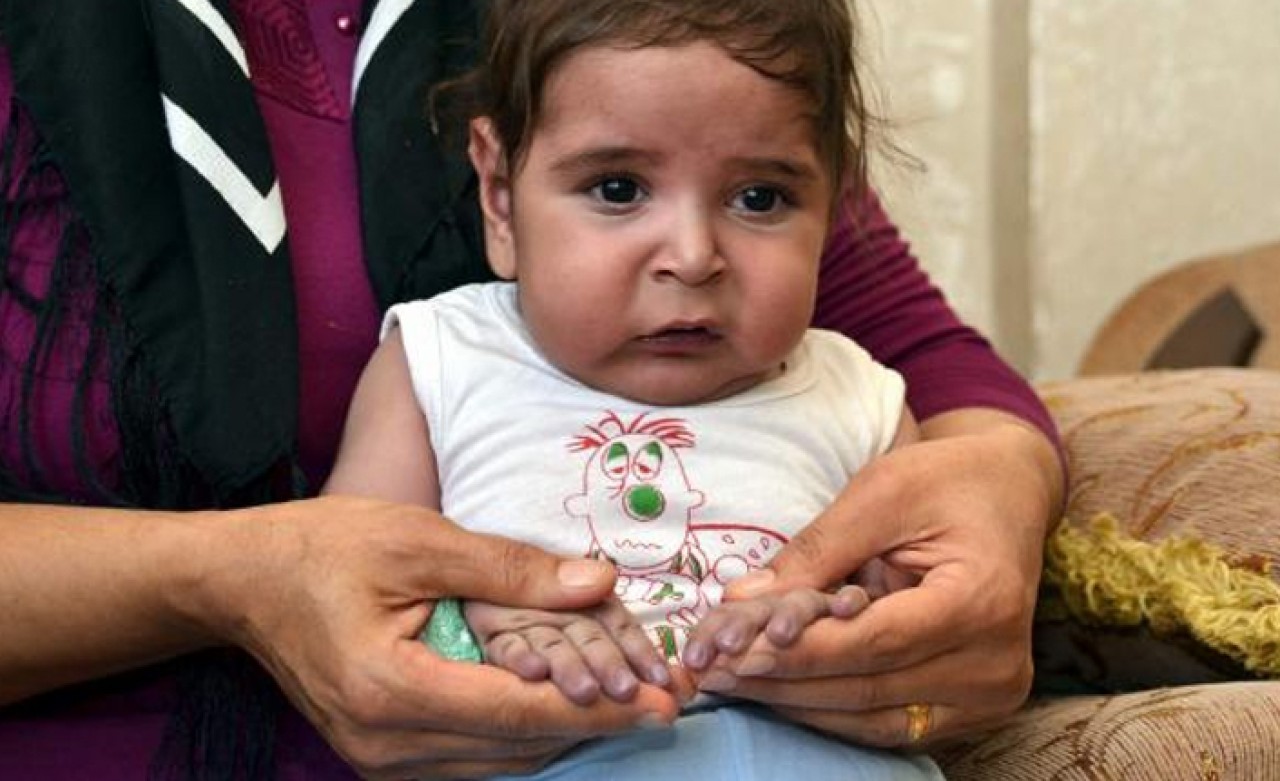 Yarım kalple dünyaya gelen minik Miraç,  yaşama tutunamadı 