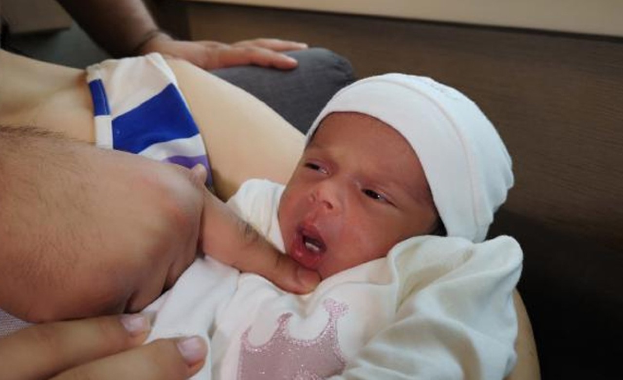 3 bin doğumda bir görülüyor... Dişleriyle dünyaya geldi