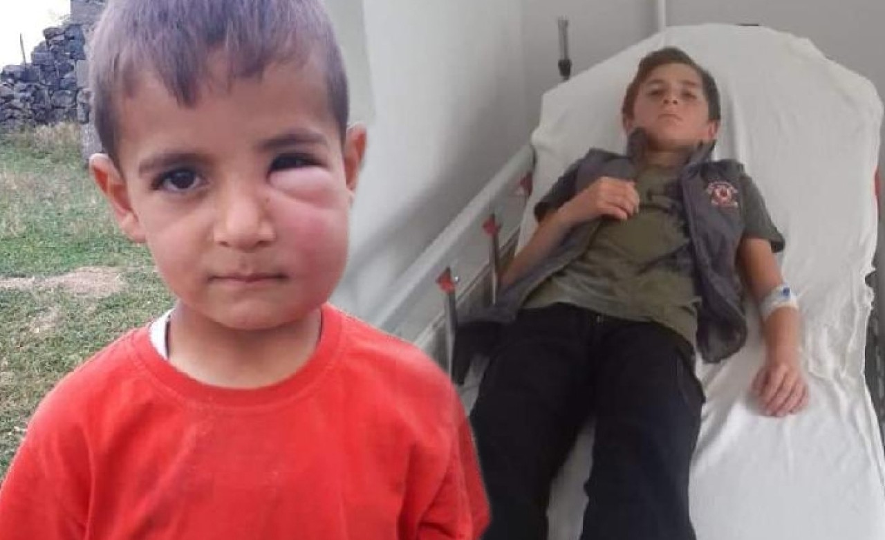 Arıların saldırısına uğrayan 2 çocuk hastaneye kaldırıldı