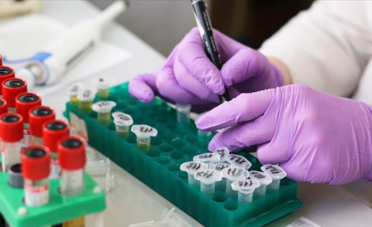 Nöronlardaki kusurlu proteinleri ayıklayan molekül bulundu