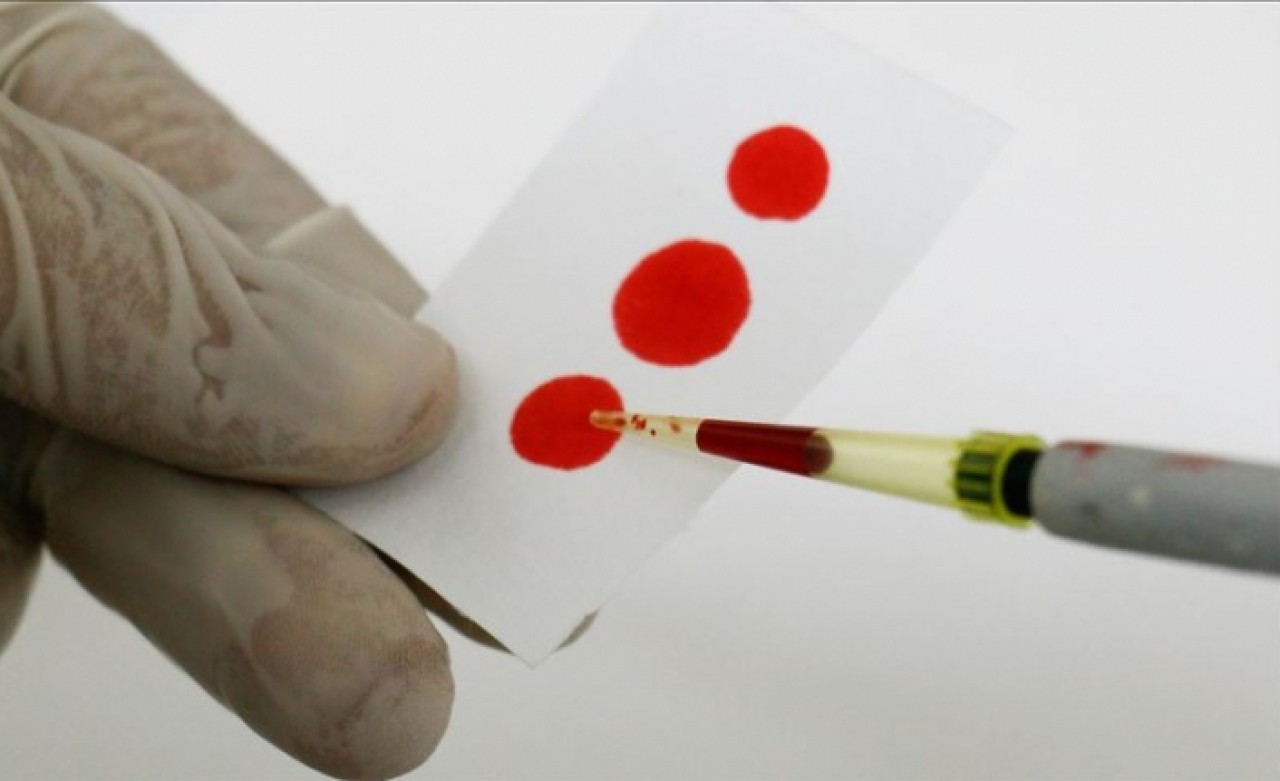 'Türkiye'de 3, 5 milyon kişi hepatit B'