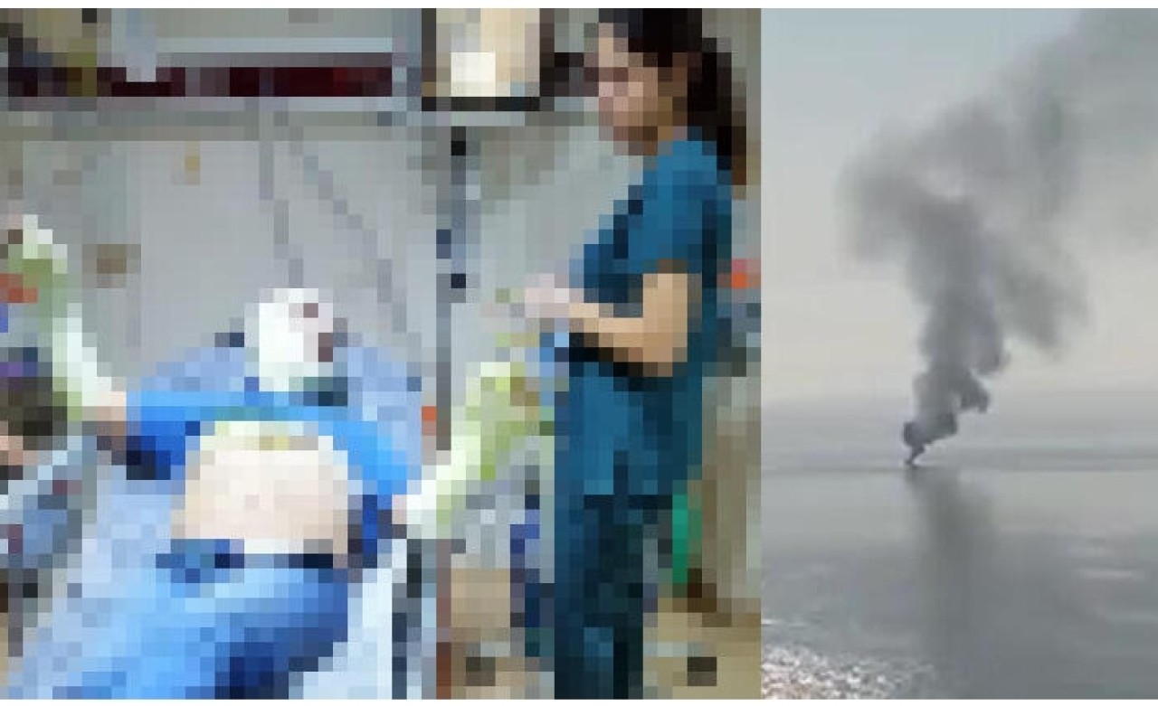 MHP İlçe Başkanı teknede çıkan yangında yaralandı