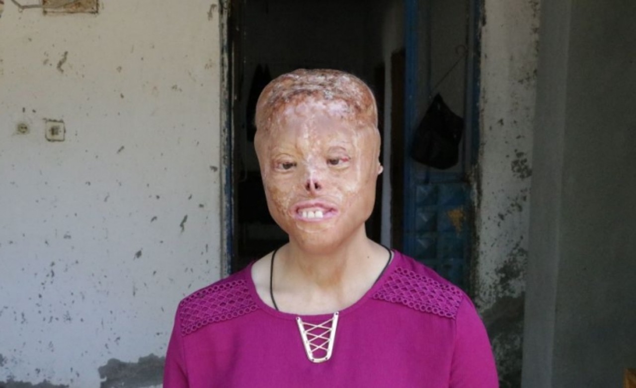 Sağlık Bakanı Koca'dan Leyla'nın tedavi süreciyle ilgili önemli açıklama