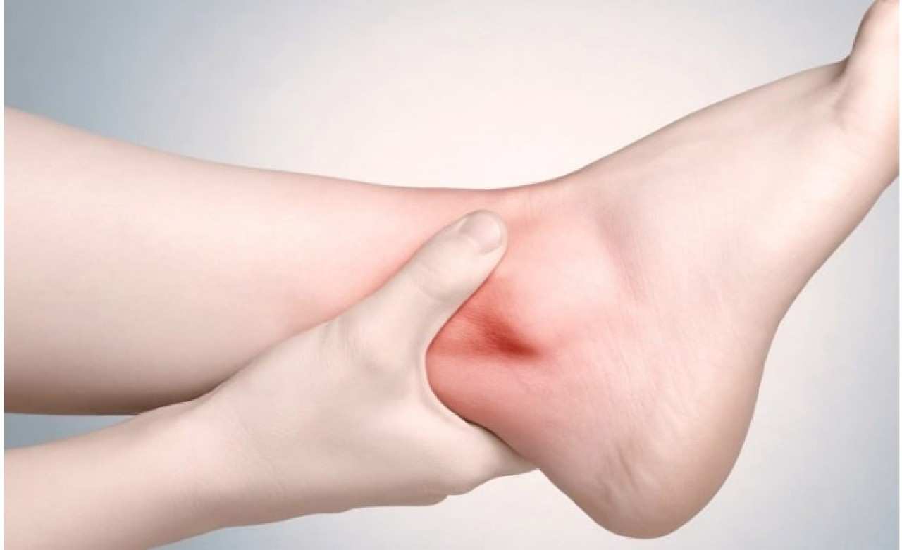 Vücutta ödem neden olur?