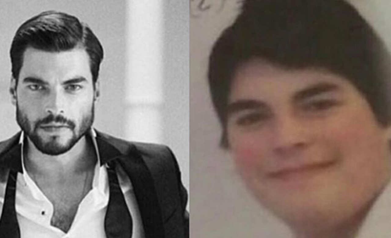 Ünlü Oyuncunun Eski Hali Şaşkına Çevirdi!