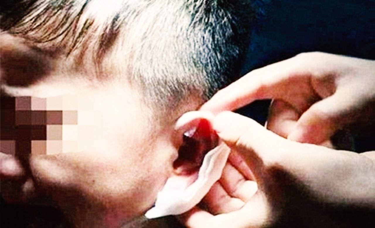 Öğrencisinin Kulağını Zımbaladı!