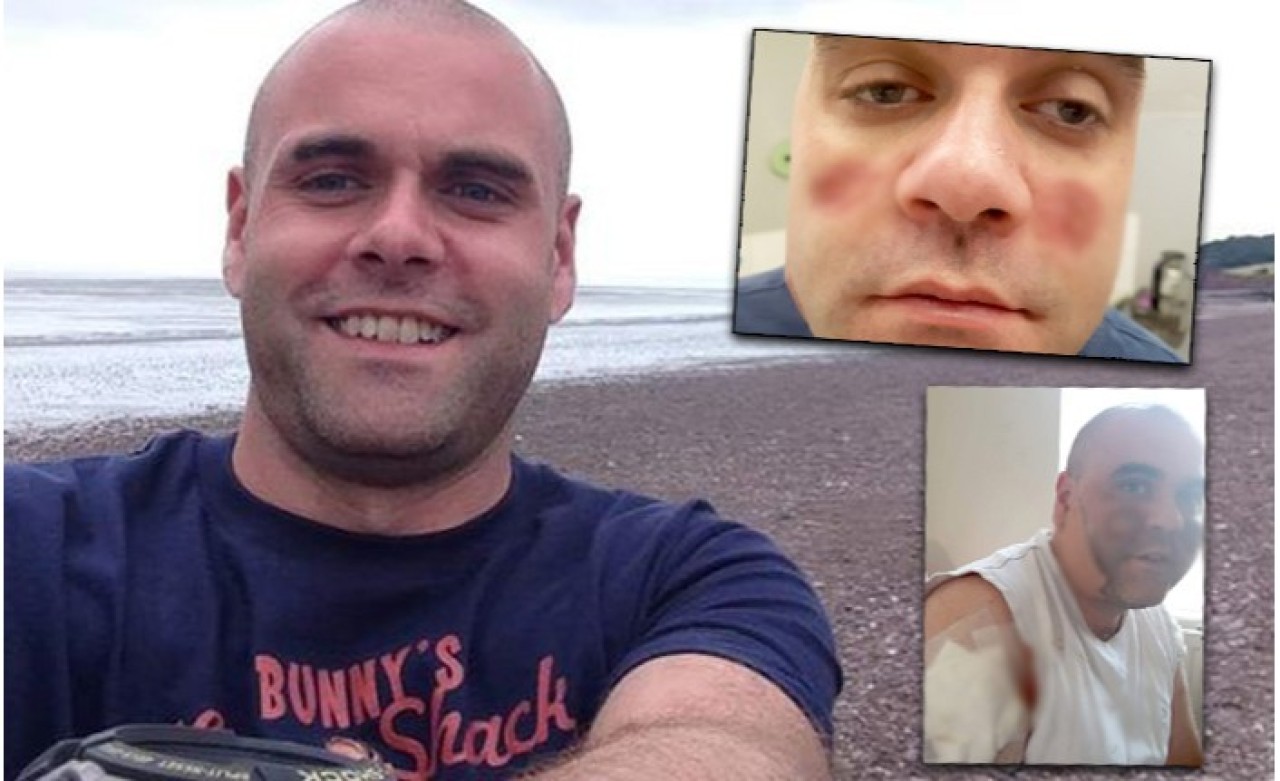 'Yaşayan Zombi'ye Dönüştü!