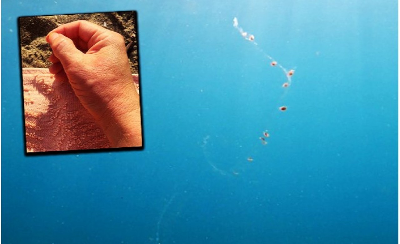 Antalya'da Denize Girenleri Elektrik Çarpıyor!