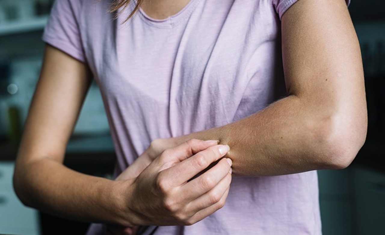 Devamlı Kaşınıyorsanız Size de Bulaşmış Olabilir!