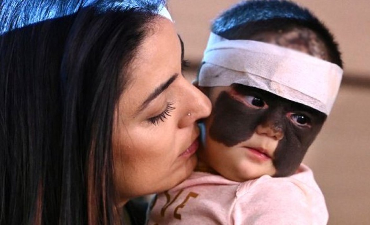 Gerçek Batman Bebek Görenleri Şaşırttı!