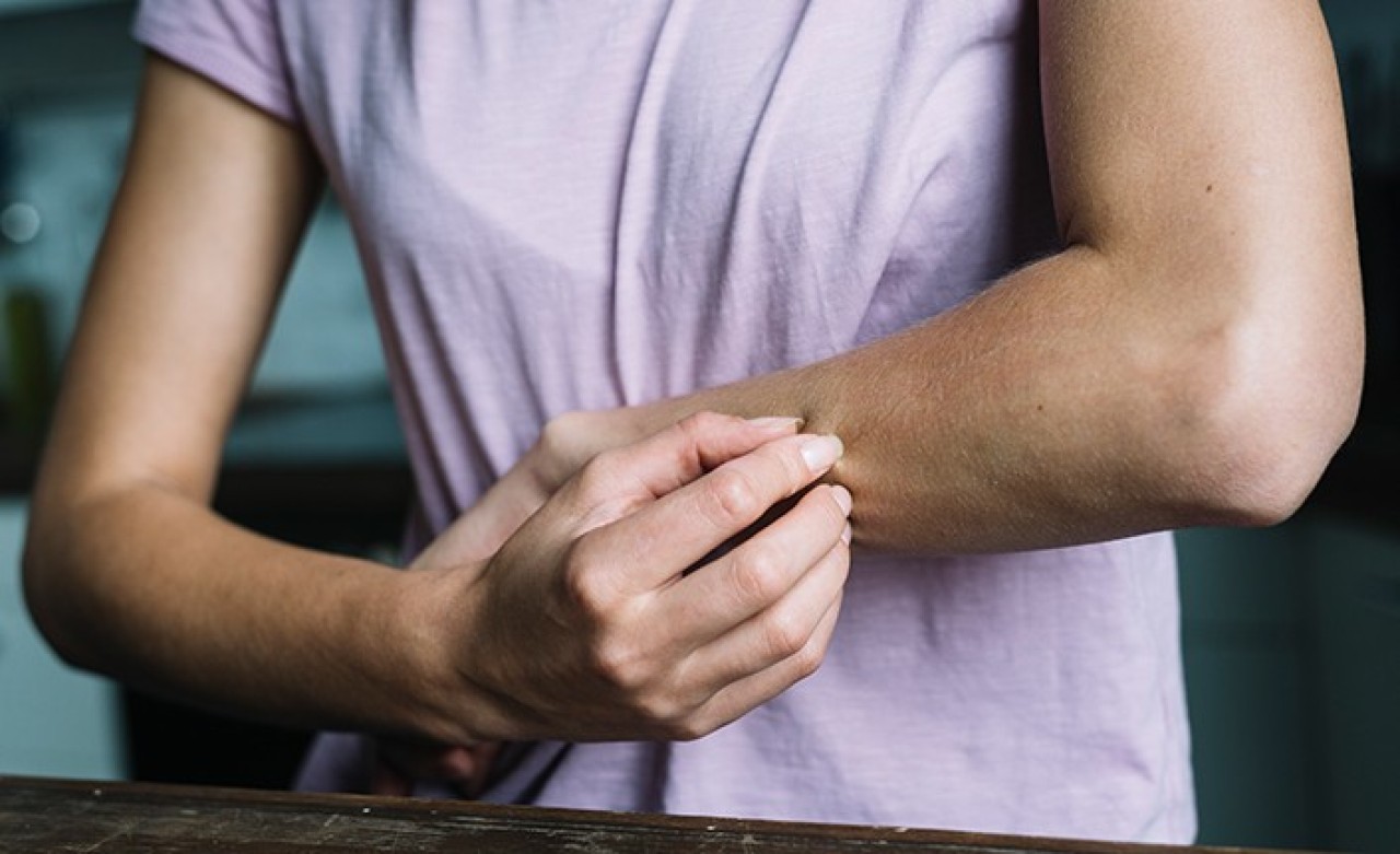 İstanbul İl Sağlık Müdürü'nden 'Uyuz' Açıklaması: Geçen Seneye Göre Artış...