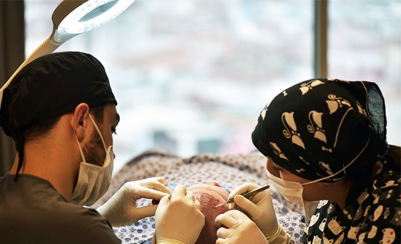 Türkiye'nin En İyi Saç Ekim Merkezi Hangisidir?