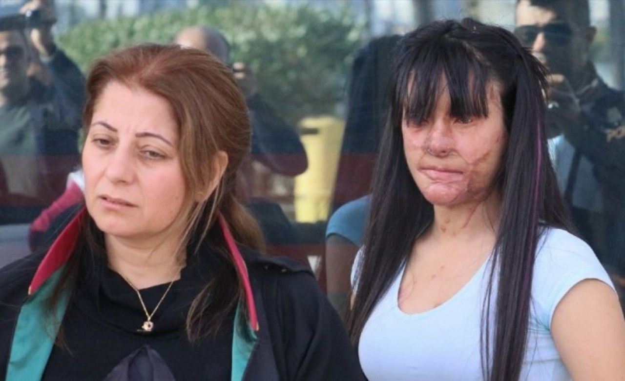 Berfin Özek,  Yüzüne Asit Döken Sanığa Verilen Ceza Hakkında Konuştu: Acılarım 13 Yıla Sığacak mı?