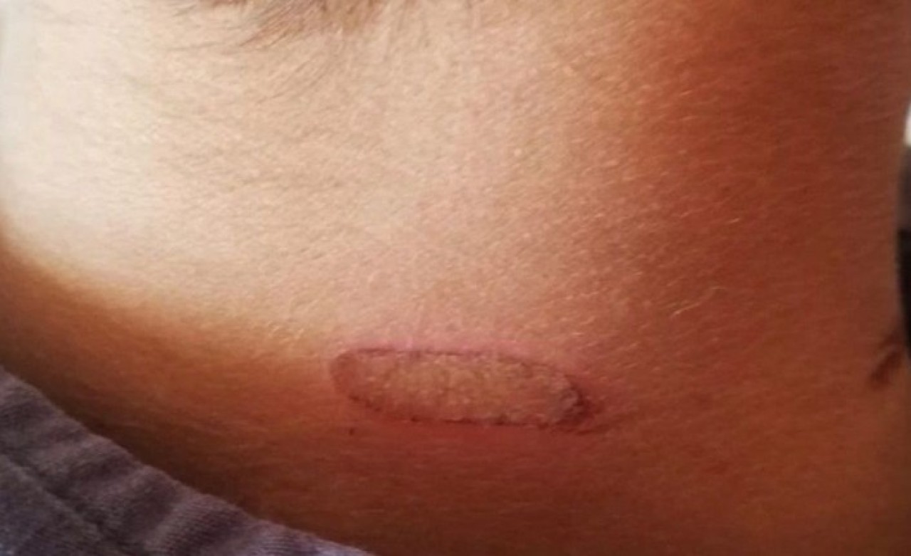 Öğrencilerin Vücuduna Sıcak Soba Izgarası Değdiren Öğretmen Açığa Alındı!