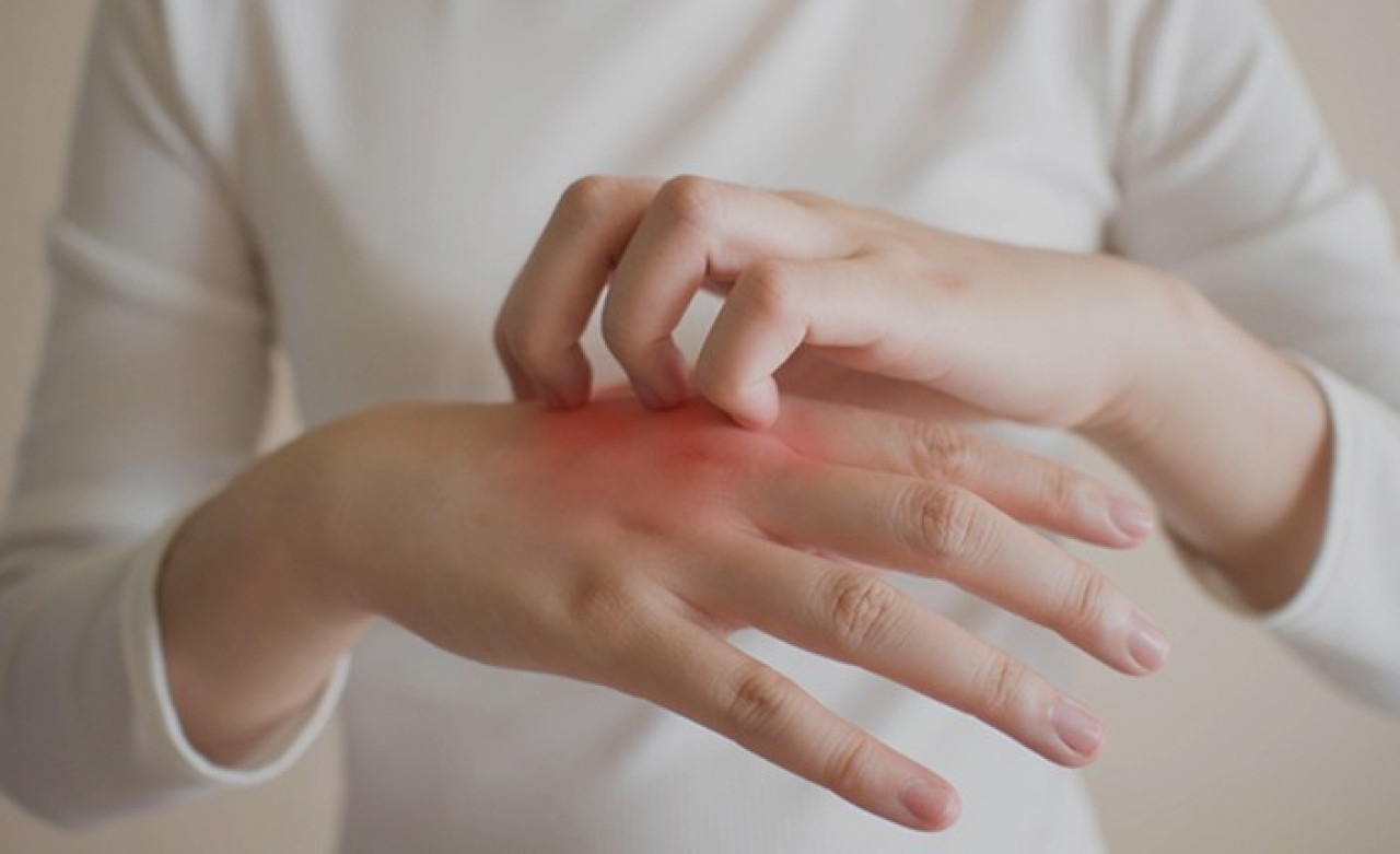 Uzmanından 'Uyuz' Uyarısı: Teknolojik Aletlere Dikkat!