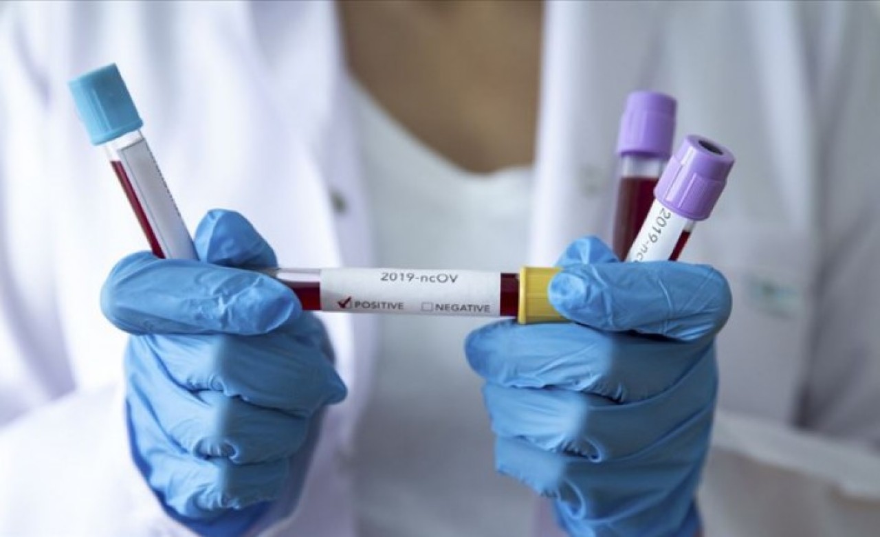 İran'daki koronavirüs ölümlerinden sonra Van'da hareketlilik başladı!