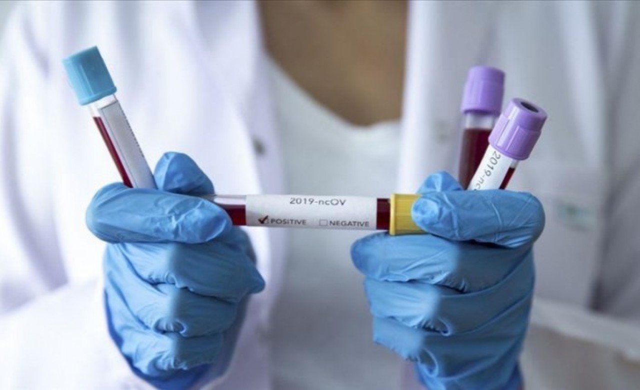 Otelde koronavirüs alarmı: Test pozitif çıkınca 1000 kişi karantina altına alındı!