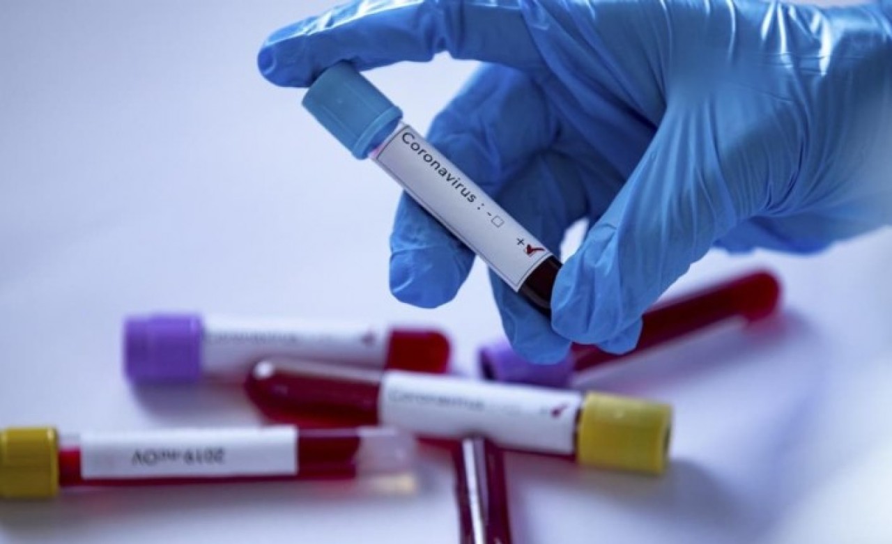 14 gün kuralına uymayan 12 vatandaşa para cezası!