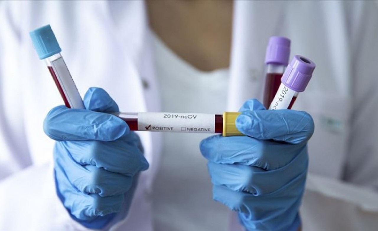 Çin'den getirilen ilaca ilişkin Bilim Kurulu Üyesi: Hastalarda hızlı iyileşmeler olabilir