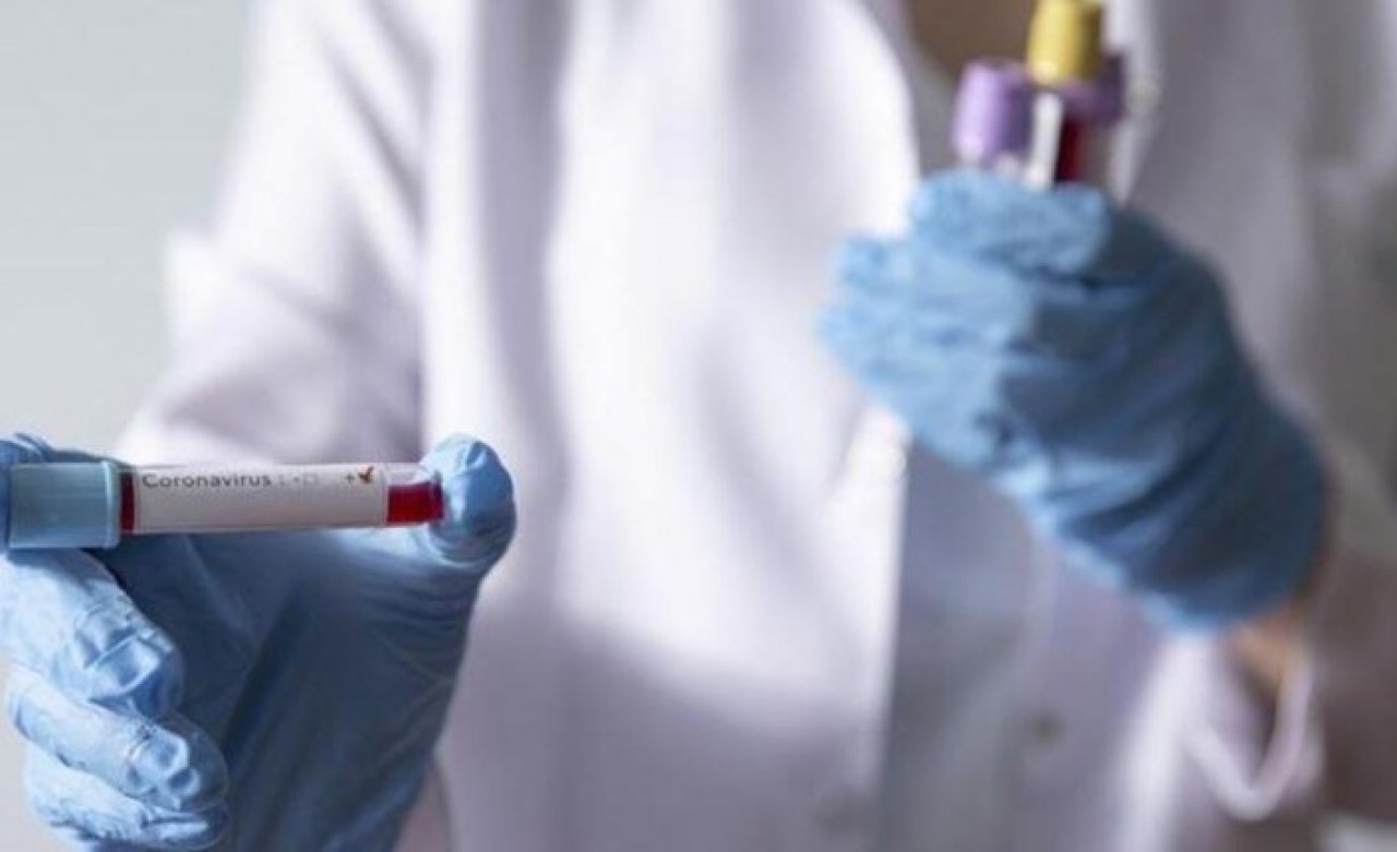 Çinliler koronavirüsü etkisiz hale getiren nanomadde buldu!