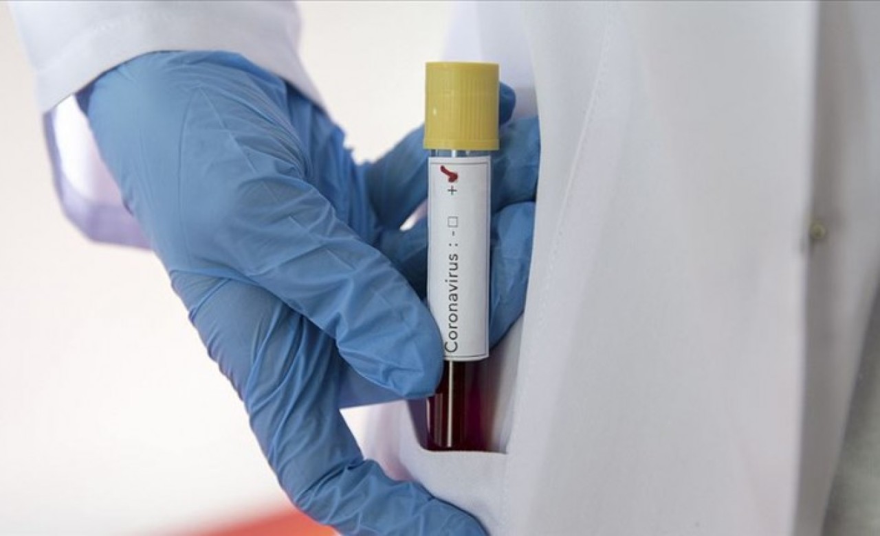 Doğum yaptıktan sonra koronavirüs nedeniyle hayatını kaybetti