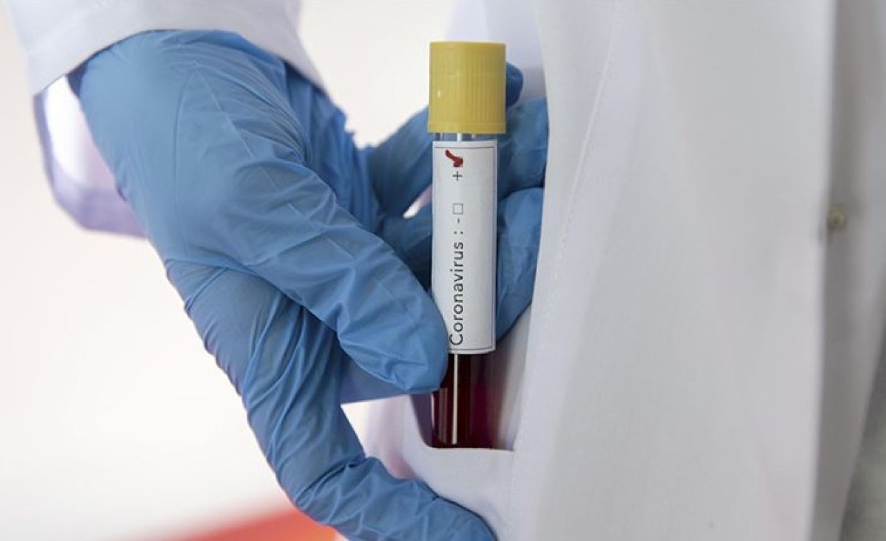 Koronavirüs aşısı geliştiriliyor: Gönüllü olana 800 TL verilecek