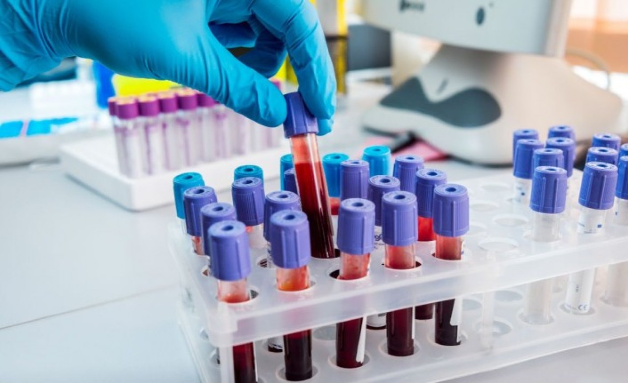 A kan grubundakiler dikkat: Koronavirüse yakalanma riskiniz daha fazla!