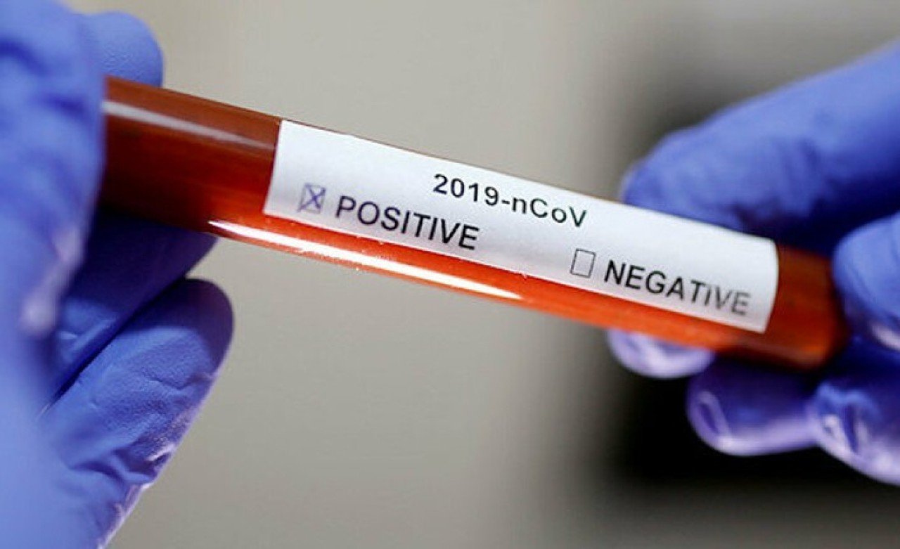 Sağlık Bakanlığı açıkladı: Koronavirüs nedeniyle yıllık izinler iptal edildi!