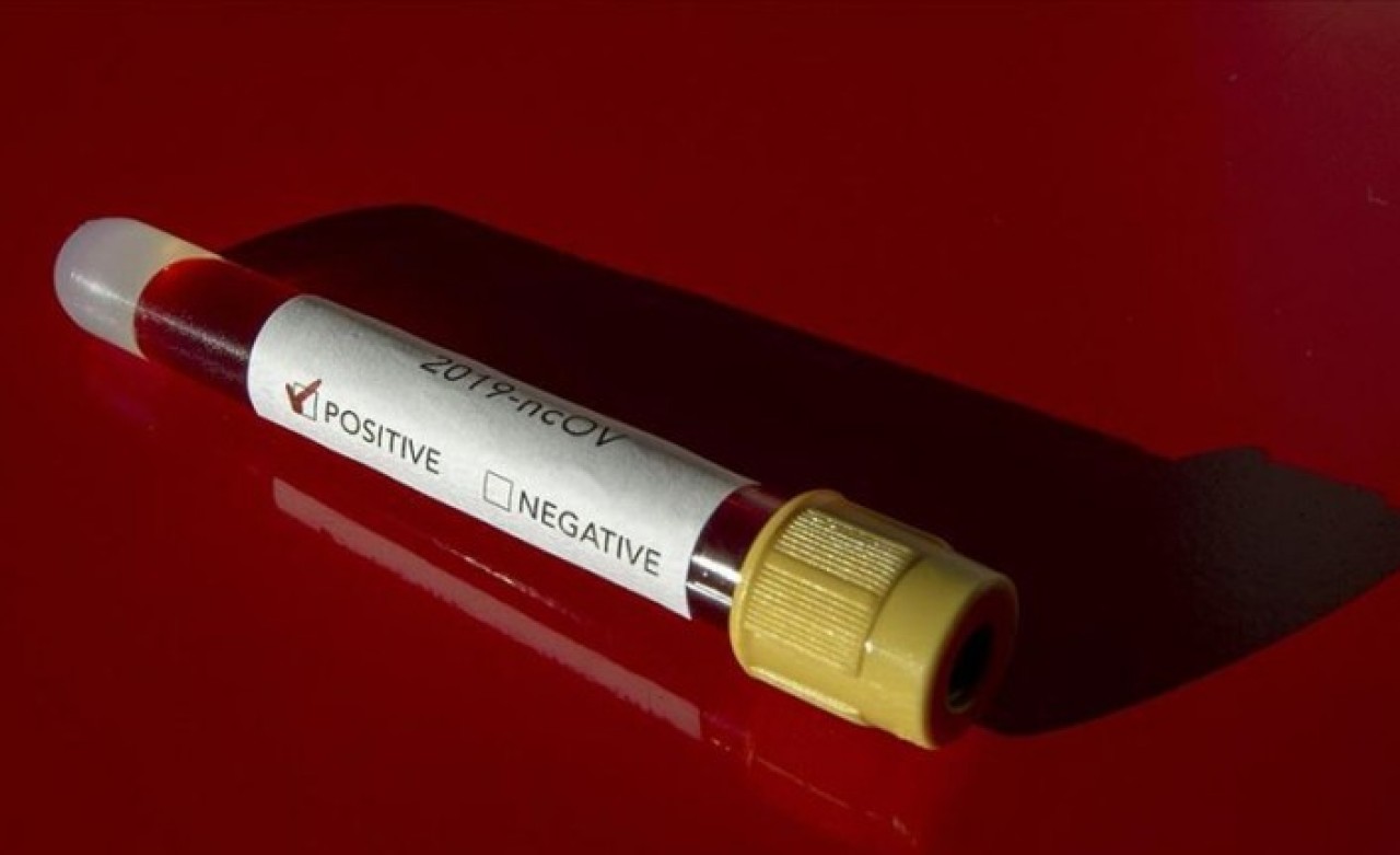 Sağlık Bakanlığı,  koronavirüs testi yaptıranların sonuçlarına ulaşacağı uygulamayı açıkladı!