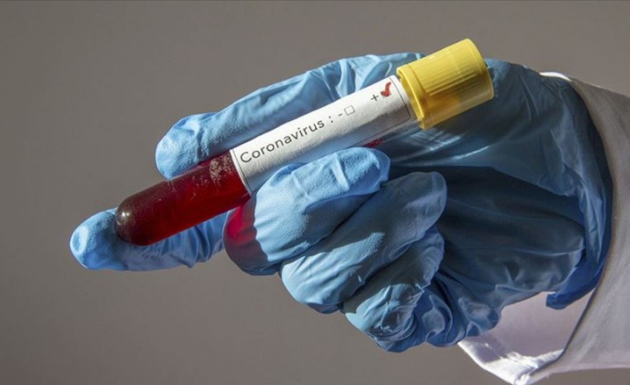 8 günlük bebeğe koronavirüs teşhisi konuldu
