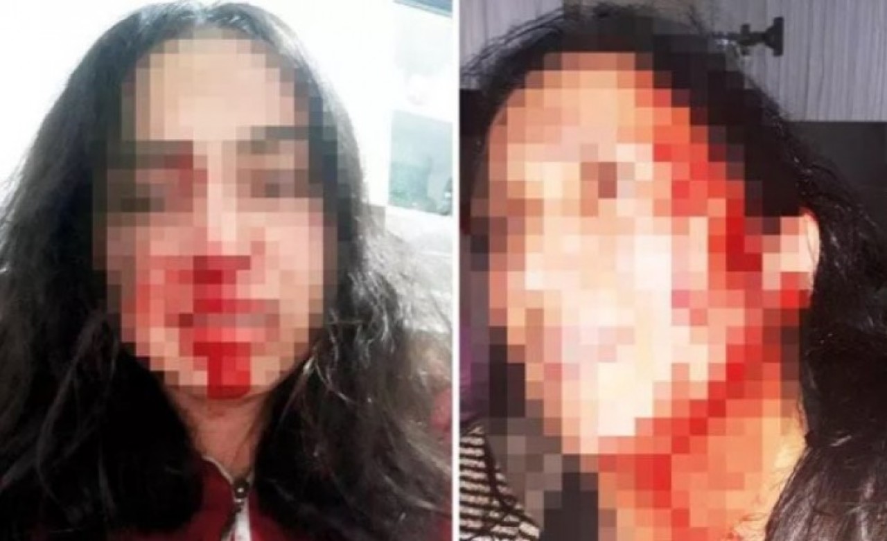 Anne ve kızın yardım çığlıkları: Bizi öldürecek,  sesimizi ölmeden duyun