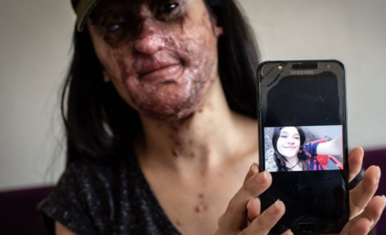 Berfin Özek kimdir? Casim Ozan Çeltik kimdir?