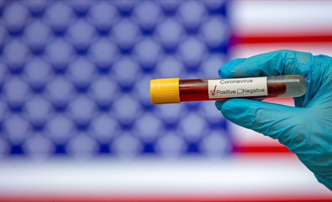 Dünya genelinde 200 binden fazla kişi koronavirüs nedeniyle öldü