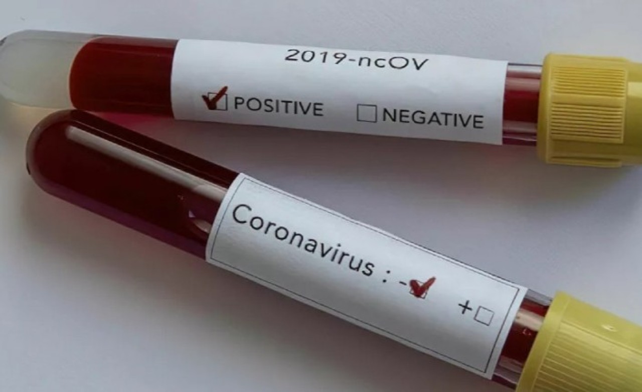 Koronavirüs hastalarını gizleyen muhtar görevden alındı