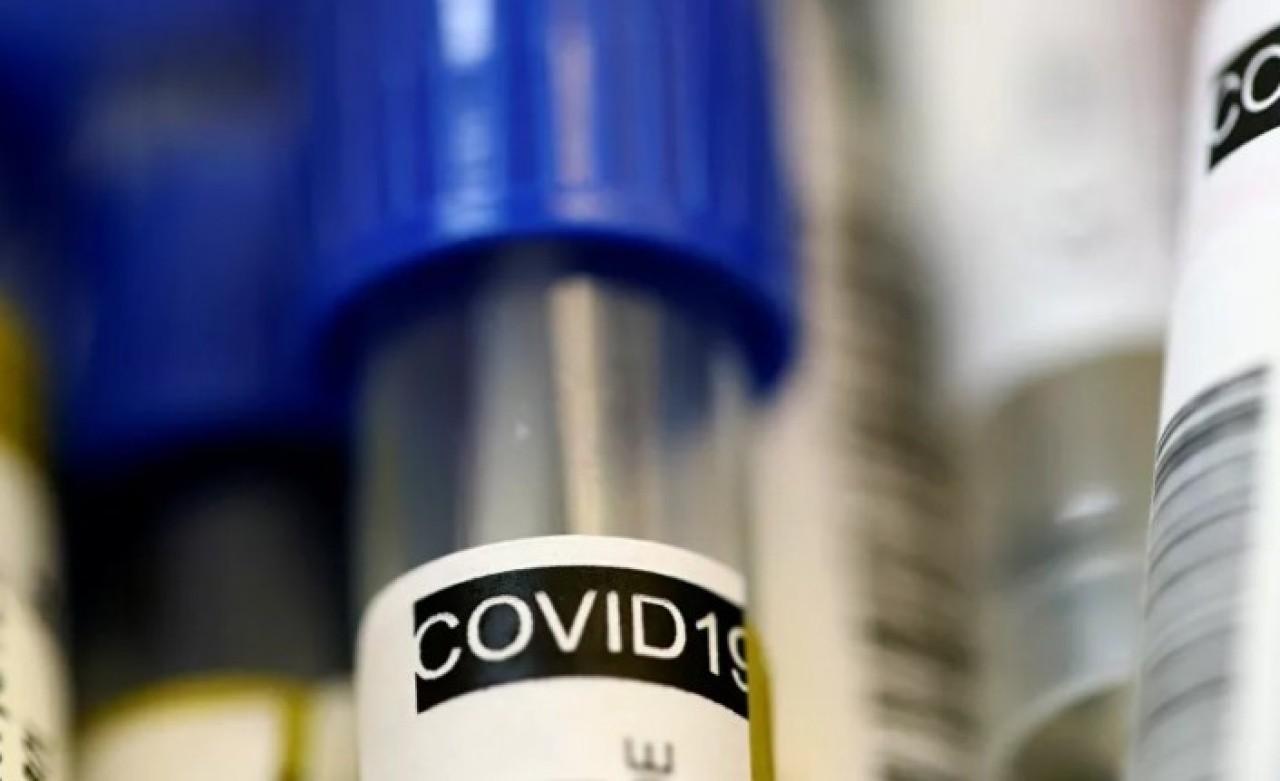 Dolandırıcılar koronavirüs kiti diye hamilelik testi satıyor