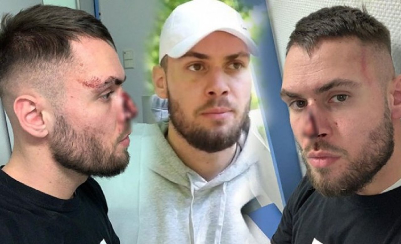 Maske takmadı diye polislerden dayak yedi!