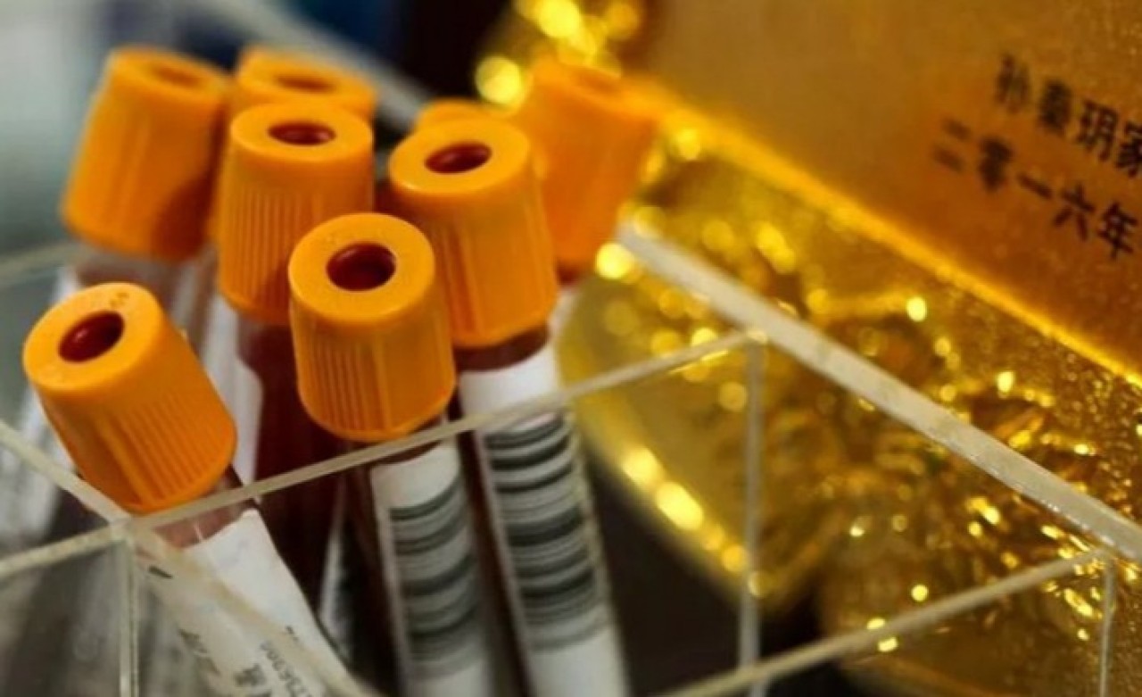 Çin'de yeni virüs tespit edildi! DSÖ'den ilk açıklama geldi