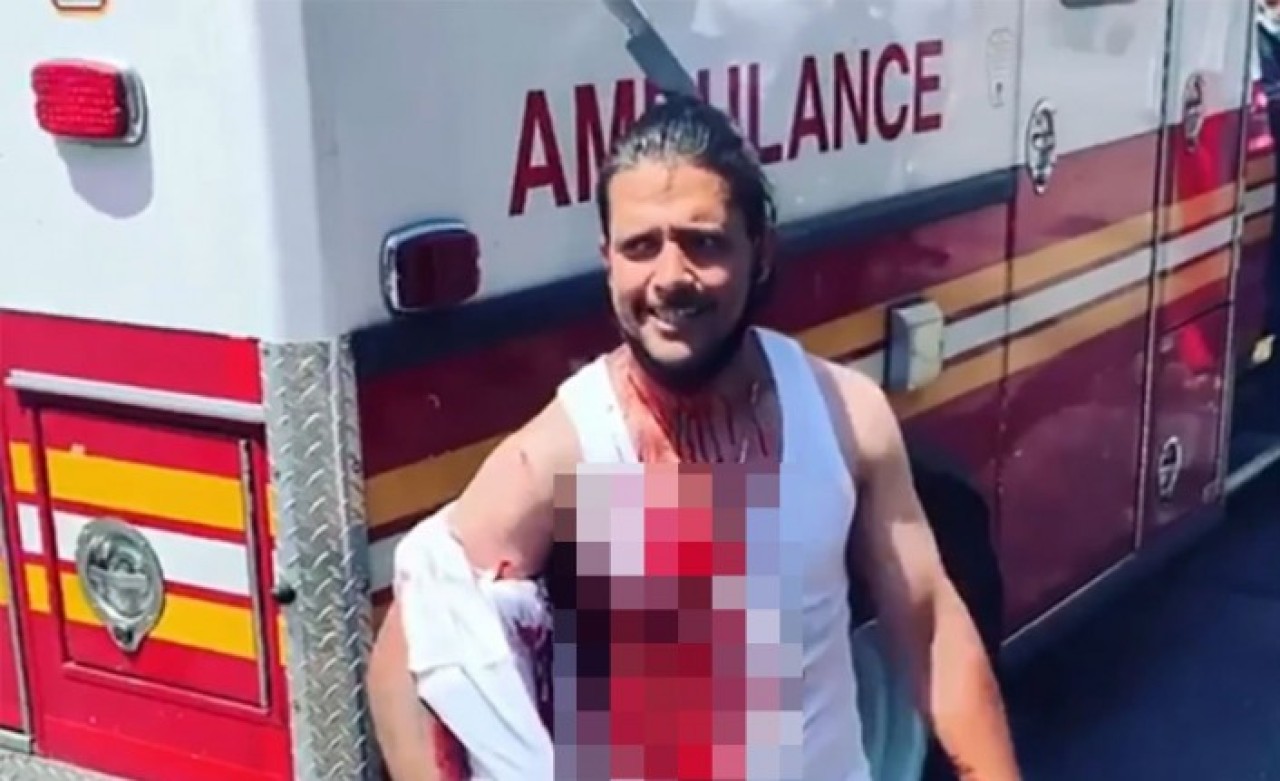 Korku filmi değil gerçek: Kafasına saplanan bıçakla sokağa fırladı