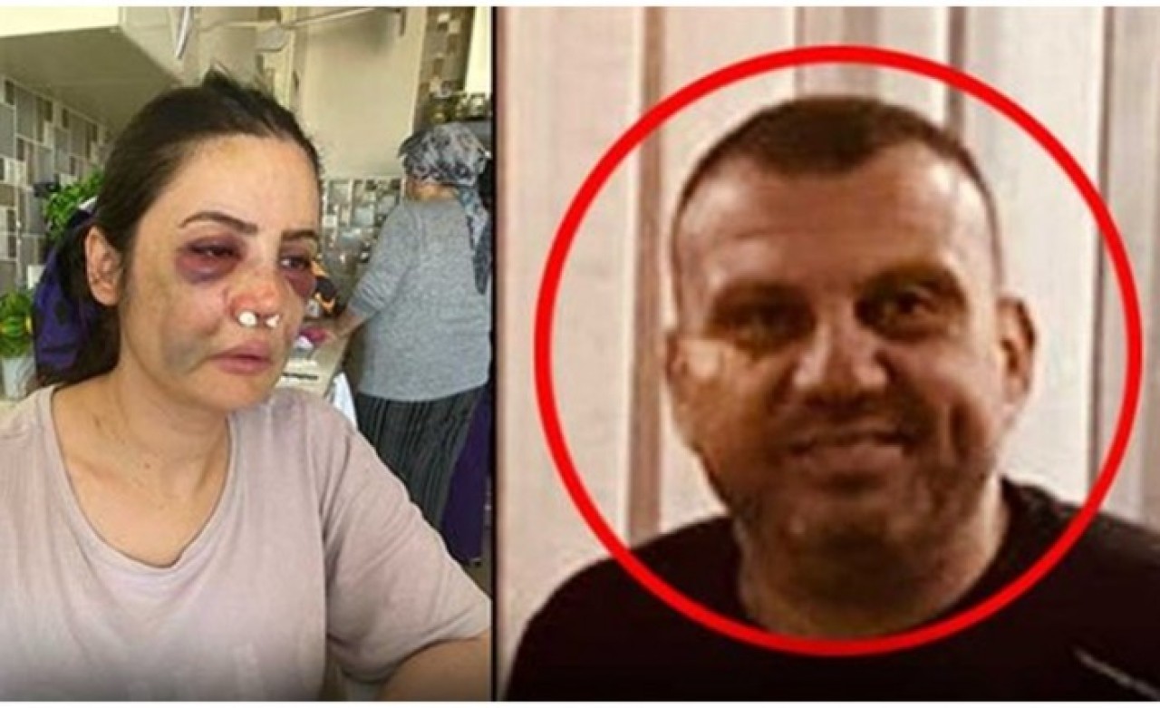 Resmen vahşet:  Erol Elbasan,  eşi Derya Elbasan'a bakın ne yaptı!